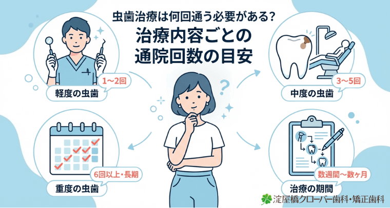 虫歯治療は何回通う必要がある？治療内容ごとの通院回数の目安