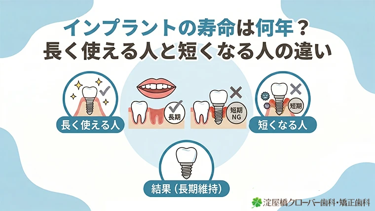 インプラントの寿命は何年？長く使える人と短くなる人の違い