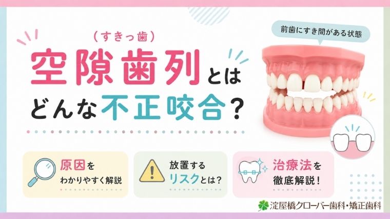 空隙歯列（すきっ歯）とはどんな不正咬合？原因・リスク・治療法を解説