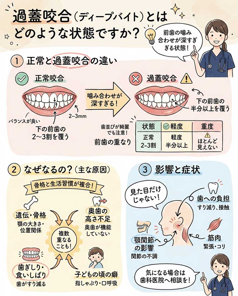 過蓋咬合（ディープバイト）とはどのような状態？の図解