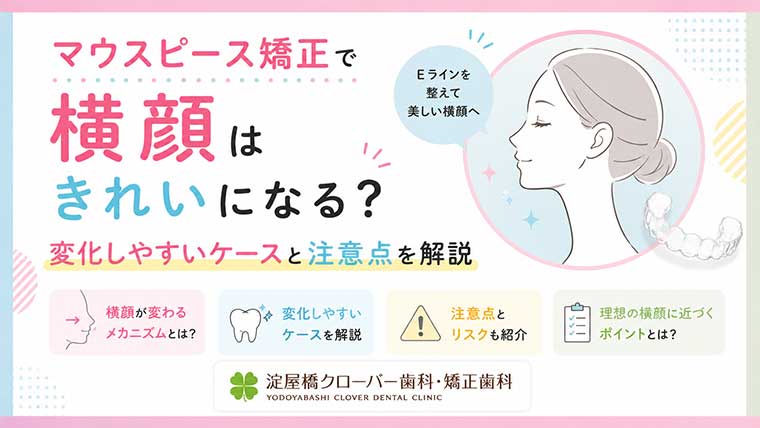 マウスピース矯正で横顔はきれいになる？変化しやすいケースと注意点を解説