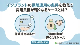 インプラントの保険適用の条件を教えて｜費用負担が軽くなるケースとは？