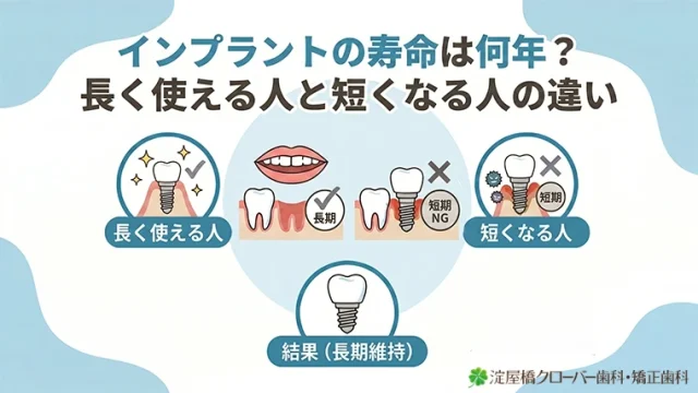 インプラントの寿命は何年？長く使える人と短くなる人の違い