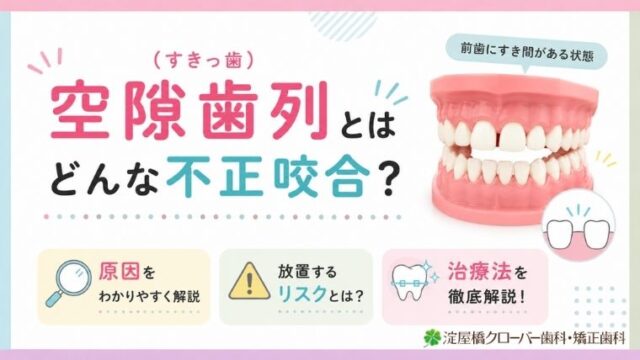 空隙歯列（すきっ歯）とはどんな不正咬合？原因・リスク・治療法を解説