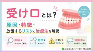受け口とは？原因・特徴・放置するリスクと治療法を解説