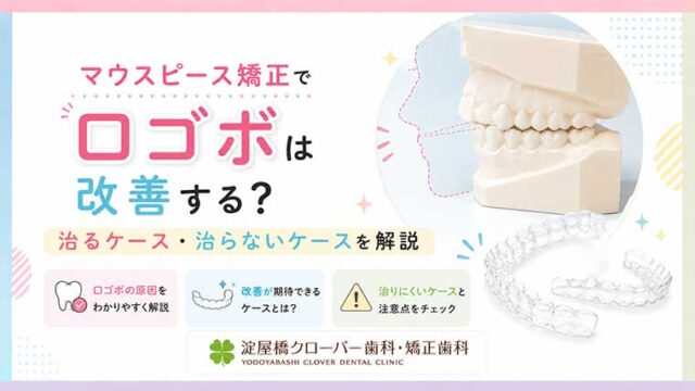 マウスピース矯正で口ゴボは改善する？治るケース・治らないケースを解説