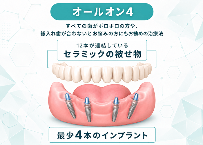 オールオン4の説明図