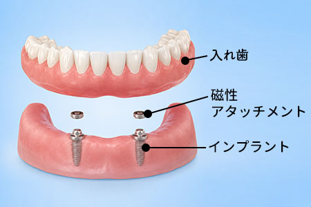 磁性アタッチメント