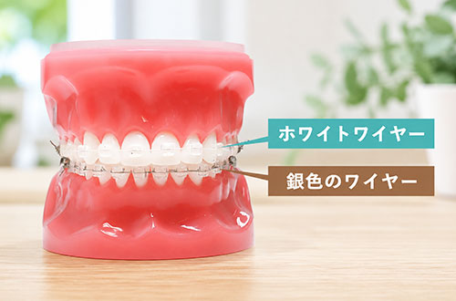 ワイヤー矯正装置を装着する歯の模型