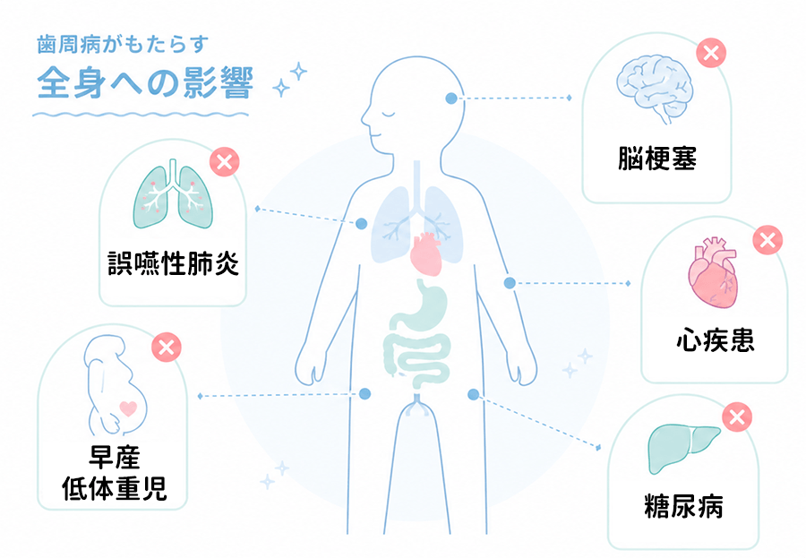 歯肉炎・歯周炎の有病者率